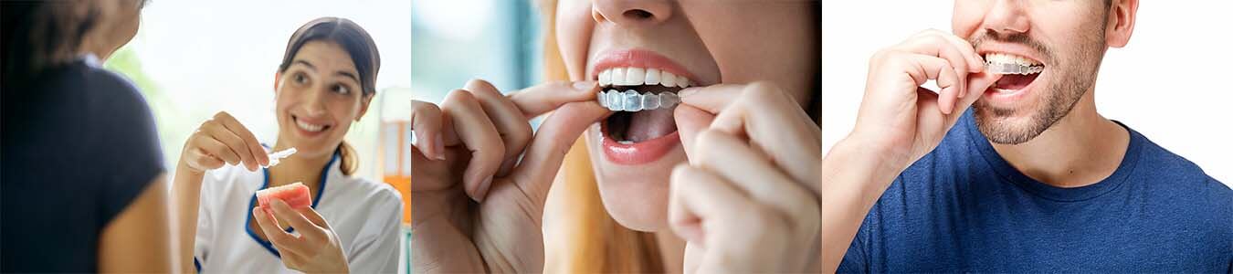 Invisalign Provider