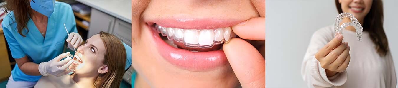 Invisalign Provider