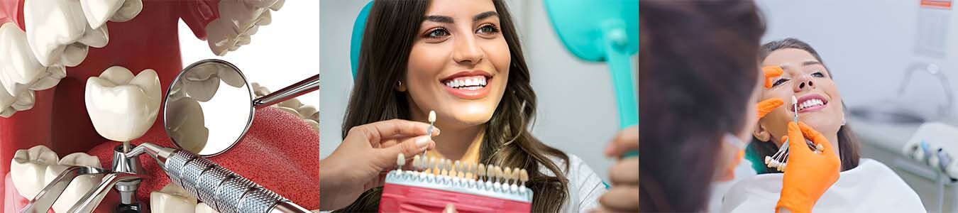 Perfect Smile With Dental Implants