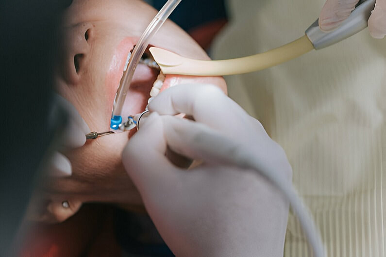 Dentist Repairing Patient Tooth