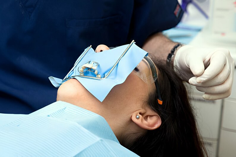 Caring for Your Dental Crowns and Bridges: Tips for Longevity